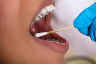 COVID Teeth : नाक, घशानंतर आता दातांमध्ये दिसणारी कोरोनाची गंभीर लक्षणे,' COVID Teeth बद्दल तज्ज्ञ काय सांगतात?