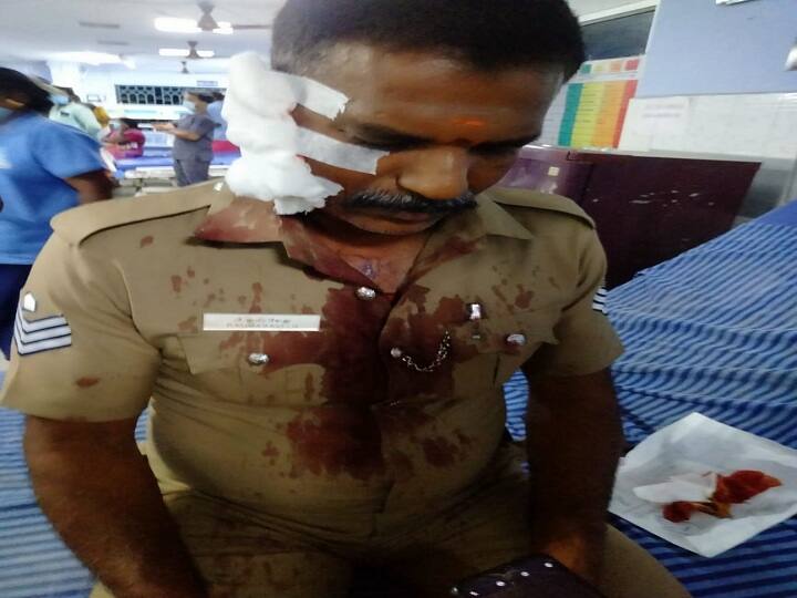 Thiruvarur: The skull of a policeman who knocked over a drunken dancer was smashed by a bottle ஆர்கெஸ்ட்ராவில் மதுபோதை நடனம்...! தட்டிக்கேட்ட காவலருக்கு பீர் பாட்டிலால் மண்டை உடைப்பு