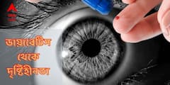 Diabetic Retinopathy : ডায়াবেটিস কেড়ে নিতে পারে দৃষ্টিও ! এই লক্ষণগুলি দেখলেই সাবধান হোন