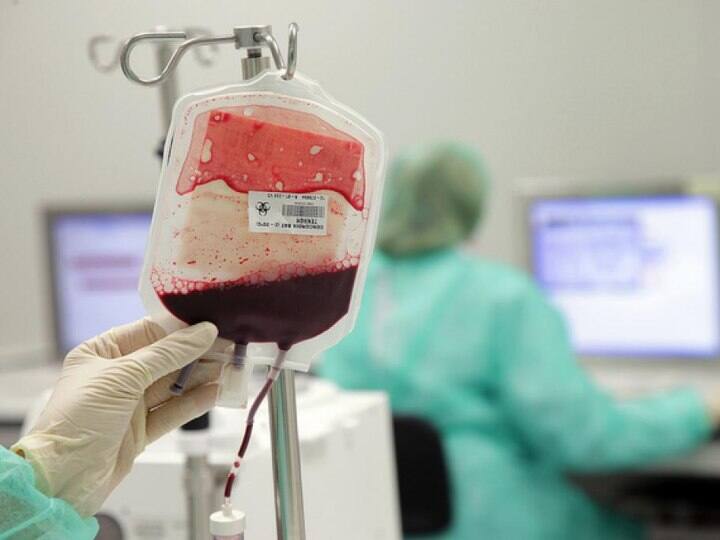 Case against two lab technicians for transfusion of HIV infected blood in Bathinda Punjab News: ਲਾਪ੍ਰਵਾਹੀ ਦੀ ਹੱਦ! ਮਰੀਜ਼ਾਂ ਨੂੰ ਚੜ੍ਹਾਇਆ ਐਚਆਈਵੀ ਪੀੜਤ ਦਾ ਖੂਨ, ਲੈਬ ਟੈਕਨੀਸ਼ੀਅਨ ਖ਼ਿਲਾਫ਼ ਕੇਸ