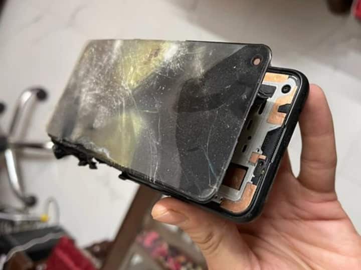 Another OnePlus Nord 2 reportedly blasts, user receives severe burns lakshay verma details Nord 2 Explodes While User Was On Call, Causes Severe Injuries, OnePlus