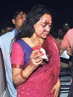 मलाइका अरोड़ा ही नहीं, बॉलीवुड के इन सितारों का भी हुआ एक्सीडेंट, सलमान से लेकर हेमा मालिनी का नाम शामिल