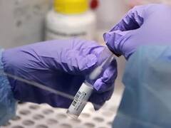 Punjab News: पंजाब के जिला अस्पतालों में प्राइवेट लैब शुरू, मिलेंगी ये सुविधाएं