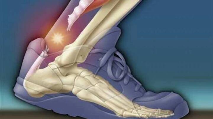 અલગ અલગ પ્રકારના રંગમાં આવતી કેરીમાં મિનરલ્સ, એન્ટીઓક્સિડન્ટ, વિટામિન કે,ભરપૂરમાં માત્રામાં છે. જે બ્લડ ક્લોટસની સાથે એનીમિયાથી બચાવ કરે છે. જે હાડકાંને મજબૂત બનાવે છે.