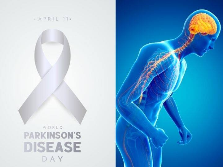 World Parkinsons Day 2022 What Causes Parkinsons Disease And What Are Early Symptoms World Parkinson's Day 2022: What Causes Parkinson's Disease And What Are Early Symptoms