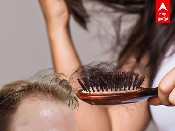 Summer Haircare Tips | கோடையில் அதிகரிக்கும் முடி உதிர்வு...என்னதான் தீர்வு?