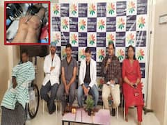 Rajahmundry News : వీపులో దిగిన ఇనుప రాడ్లు, క్లిష్టమైన ఆపరేషన్ చేసి బాధితుడి ప్రాణాలు నిలిపిన వైద్యులు