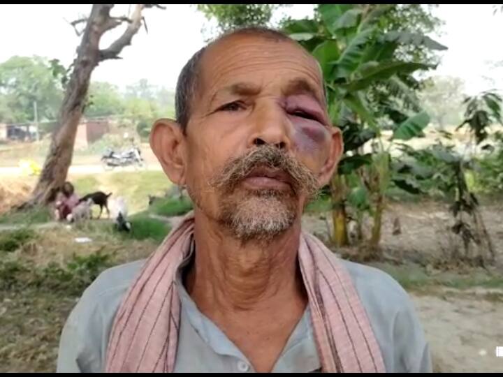 Basti News: बस्ती में बढ़ता जा रहा है आवारा पशुओं का आतंक, सांड के हमले से बुजुर्ग की हालत गंभीर Basti terror of stray animals old man was seriously injured due to bull attack ANN Basti News: बस्ती में बढ़ता जा रहा है आवारा पशुओं का आतंक, सांड के हमले से बुजुर्ग की हालत गंभीर