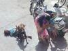Madhya Pradesh News: मध्य प्रदेश में आवारा कुत्ते ने मासूम पर किया हमला, घायल बच्ची अस्पताल में भर्ती