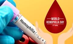 Haemophilia Symptoms: নিরাময় নেই কোনও, বংশানুক্রমেই শরীরে বাসা বাঁধে হিমোফিলিয়া