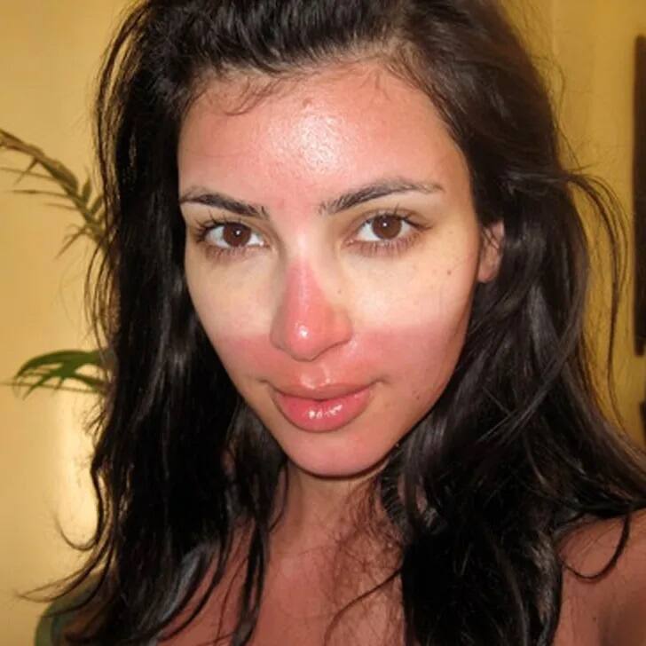 Do not commit these mistake after  sunburn Summer skinCare tips  સનબર્ન  બાદ આપ પણ મેકઅપ કરો છો? તો સાવધાન થઇ શકે છે સ્કિનને આ નુકસાન