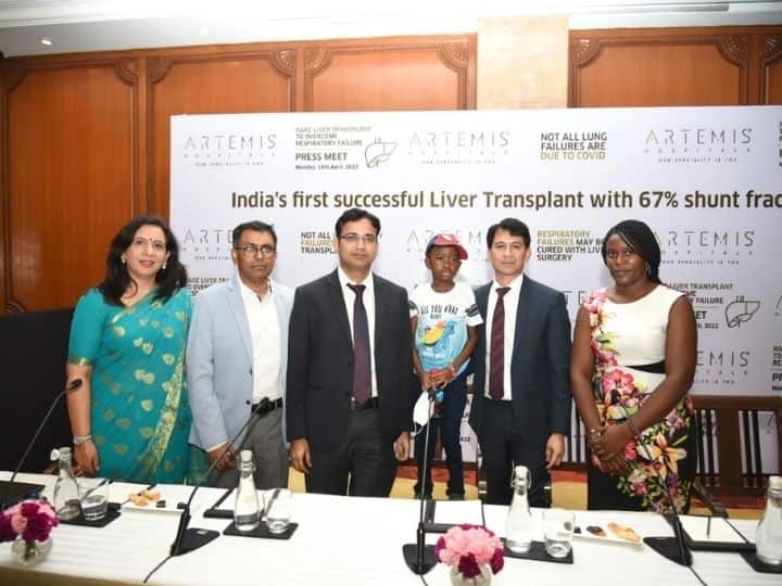World Liver Day 2022 Zimbabwean Boy 'Breathing On His Own' After Rare Liver Transplant 'With 67% Shunt Fraction' At Gurugram Hospital Zimbabwean Boy 'Breathing On His Own' After Rare Liver Transplant 'With 67% Shunt Fraction' At Gurugram Hospital