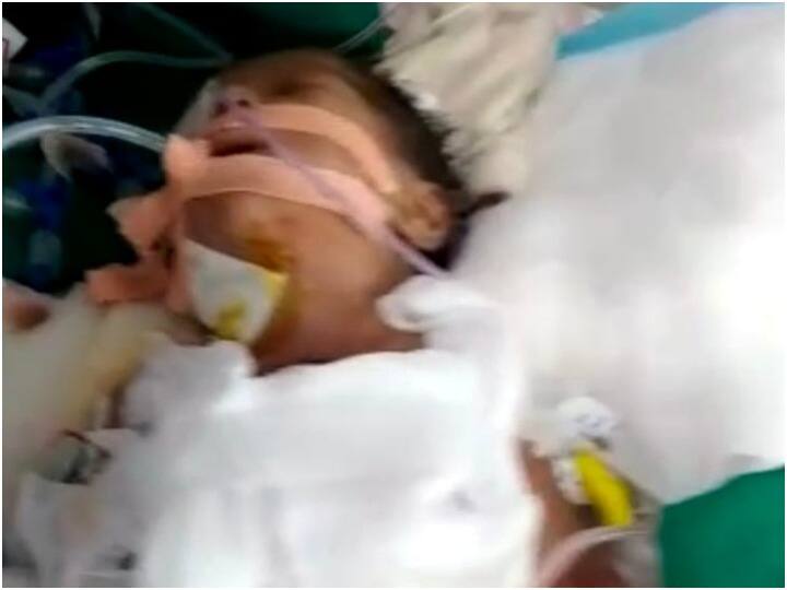 MP News On the initiative of the collector the successful operation of the heart of a 20 day old girl ANN MP News: सिस्टम करे काम तो सबको मिले आराम, कलेक्टर की पहल पर 20 दिन की बच्ची के दिल का हुआ सफल ऑपरेशन