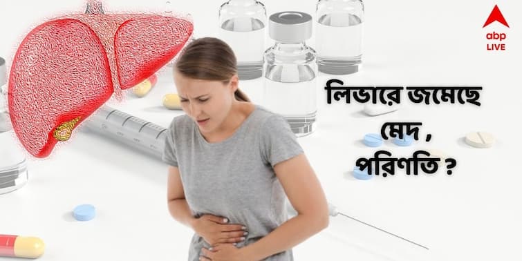 World Liver Day 2022   tips you should follow to avoid fatty liver syndromes World Liver Day 2022: ফ্যাটি লিভারের সমস্যা অগ্রাহ্য করলে ভয়ঙ্কর বিপদ আসন্ন ! এই উপসর্গগুলি দেখলেই সাবধান হোন