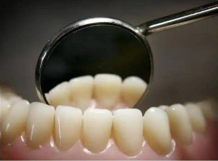 fatal accident happened with person during filling of teeth, swallowed dentists drill bit ਸ਼ਖਸ ਨਾਲ ਵਾਪਰਿਆ ਭਿਆਨਕ ਹਾਦਸਾ, ਦੰਦਾਂ ਦੇ ਡਾਕਟਰ ਦੀ ਡਰਿੱਲ ਬਿਟ ਨਿਗਲੀ