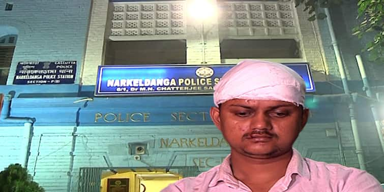 North 24 Parganas Narkeldanga man allegedly beaten up after lodging complaint about electricity theft North 24 Parganas News: বিদ্যুৎ চুরি নিয়ে নালিশ CESC-র কাছে, নারকেলডাঙায় হামলা প্রতিবাদী যুবকের উপর, প্রাণের বাঁচলেন অল্পের জন্য