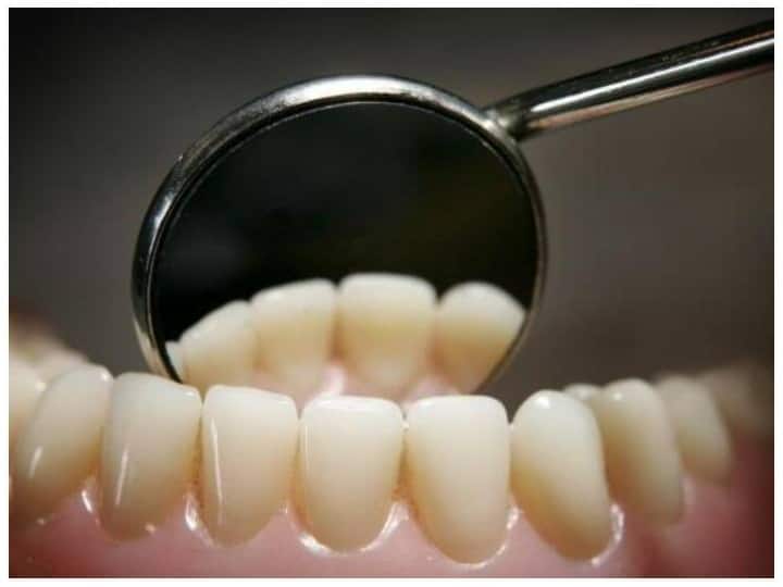 Man swallowed dentist drill bit while filling teeth दांतों की फिलिंग के दौरान शख्स के साथ हुआ जानलेवा हादसा, निगल लिया डेंटिस्ट का ड्रिल बिट 