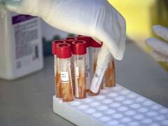 Jaipur Corona Update: जयपुर में पिछले सात दिनों में कोरोना के कितने केस आए? जानें वैक्सीनेशन का आंकड़ा