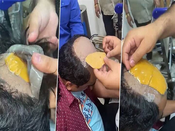 Delhi Gold Smuggling: அயன் பட பாணியில் விக் முடிக்குள் தங்கம்.. அலேக்காய் பிடித்த அதிகாரிகள்.. வைரல் வீடியோ..