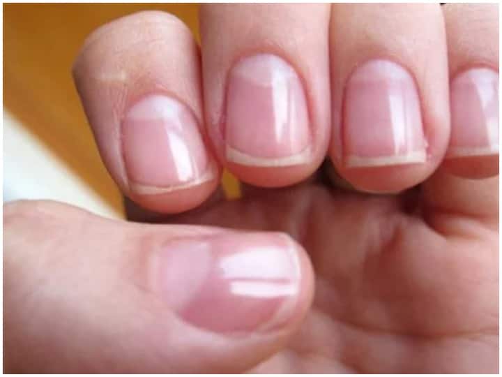 Nails tell the secret of your Health, Health Care Tips Health Care Tips: नाख़ून बताते हैं आपकी सेहत के राज, जानें