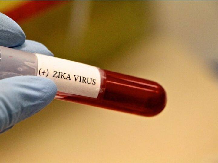 Zika Virus Can Become Even More Dangerous With A Small Mutation: Study Zika Virus Can Become Even More Dangerous With A Small Mutation: Study