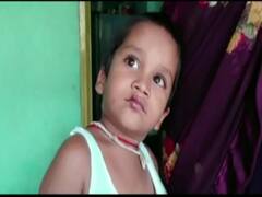 Anantapur News : అనంతపురంలో దారుణం, బాలుడి మూతిపై వాత పెట్టి అంగన్వాడీ ఆయా