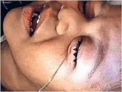 Ajmer में मेडिकल टीम को मिली सफलता, मासूम की आंख में घुसा 15 सेमी का तार निकाला