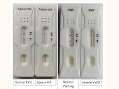 ICMR-NIIH ने हीमोफिलिया और VWD के लिए बनाई किट, जल्दी मिलेगा टेस्ट का रिजल्ट