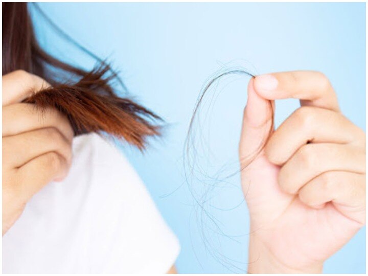 Health Tips: This May Be The Reason Behind Hair Loss, Hair Care Tips | Hair  Care Tips: बालों के झड़ने के पीछे हो सकती हैं ये वजह, जानिए