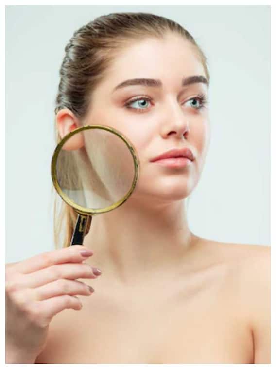 स्किन से पिग्मेंटेशन की परेशानी को दूर करने में प्रभावी हैं ये नुस्खे