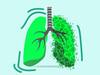 Asthma: ఆస్థమా వారసత్వంగా వస్తుందా? ఒక్కసారి వస్తే శాశ్వతంగా ఉండిపోతుందా?
