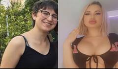 Human Barbie: હૉટ મૉડલને સ્તન-હોઠને ભરાવદાર બનાવવાનો લાગ્યો ચસ્કો, સર્જરીમાં ખર્ચ્યા 50 લાખ ને પછી..............