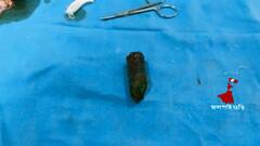 Jalpaigur News: জেলার সরকারি হাসপাতালের জটিল অস্ত্রোপচার কিশোরের, কানের পিছন থেকে বেরলো গাছের ডাল