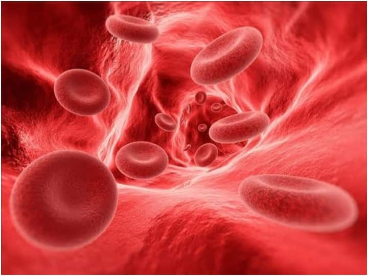 Gurugram Iron deficiency anemia in women, know how to prevent it Gurugram News: महिलाओं में आयरन की कमी से होने वाला एनीमिया, जानें इसे कैसे रोकें?