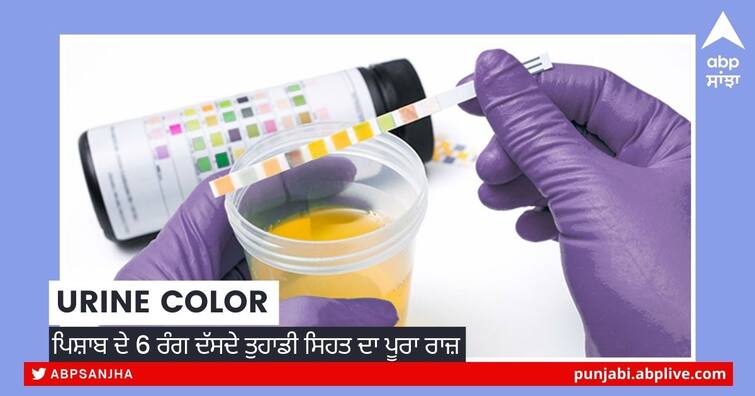 urine color indicate multipal things about your health and lifestyle know the signs in Punjabi Urine Color: ਪਿਸ਼ਾਬ ਦੇ 6 ਰੰਗ ਦੱਸਦੇ ਤੁਹਾਡੀ ਸਿਹਤ ਦਾ ਪੂਰਾ ਰਾਜ਼, ਇੰਝ ਜਾਣੋ ਤੁਸੀਂ ਸਿਹਤਮੰਦ ਜਾਂ ਕੋਈ ਬਿਮਾਰੀ