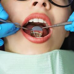 દાંતને કેવિટીથી બચાવવા માટે અને તેને સાચવા માટે ફોલો કરો આ ટિપ્સ, ટીથ હેલ્થ માટે જરૂરી છે