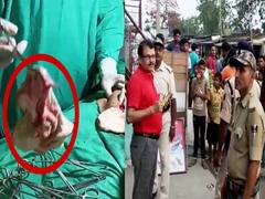 बिहार के डॉक्टर का अजब-गजब 'कारनामा', ऑपरेशन किया और महिला के पेट में छोड़ दिया कपड़े का टुकड़ा, हो गई मौत