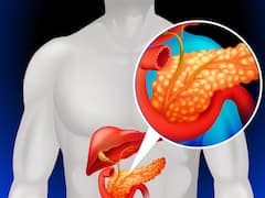 Pancreatic Cancer: शरीर में इन लक्षणों को देखते ही हो जाएं सावधान, पैंक्रियाज कैंसर का हो सकता है इशारा