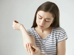 Dark Elbows Remedies : इन 6 घरेलू उपायों से करें कोहनी का कालापन दूर