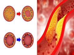 High Cholesterol: உடலில் அதிக அளவு கொழுப்பு எவ்வளவு ஆபத்து? அபாய அறிகுறிகள் என்னென்ன?