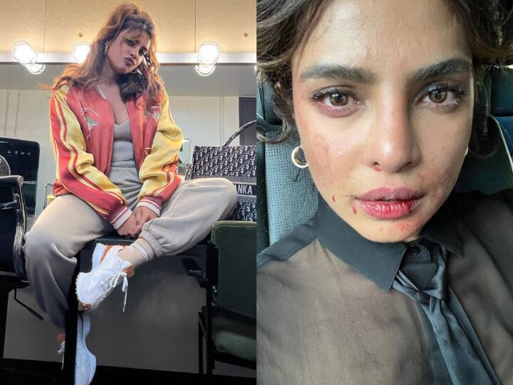 actress priyanka chopra injured on sets of film shooting શૂટિંગ સેટ પર ઘાયલ થઇ 'દેસી ગર્લ', લોહીથી લથપથ ચહેરાની તસવીર વાયરલ, જુઓ...