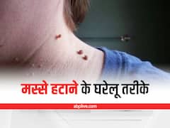 Skin Tags: त्वचा से टैग्स हटाने के लिए अपनाएं ये घरेलू तरीका, नहीं होगा दर्द और परेशानी