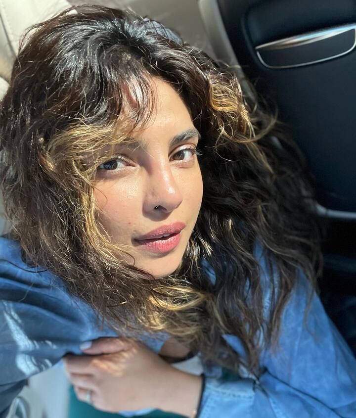 प्रियांकानं शेअर केलेल्या फोटोमध्ये तिच्या चेहऱ्याला दुखापत झालेली दिसत आहे.(photo:priyankachopra/ig)