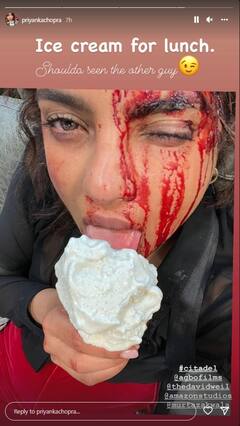 प्रियंका चोपड़ा के फैंस नहीं देख पाएंगे उनकी ऐसी हालत! एक्ट्रेस ने शेयर की ये तस्वीर