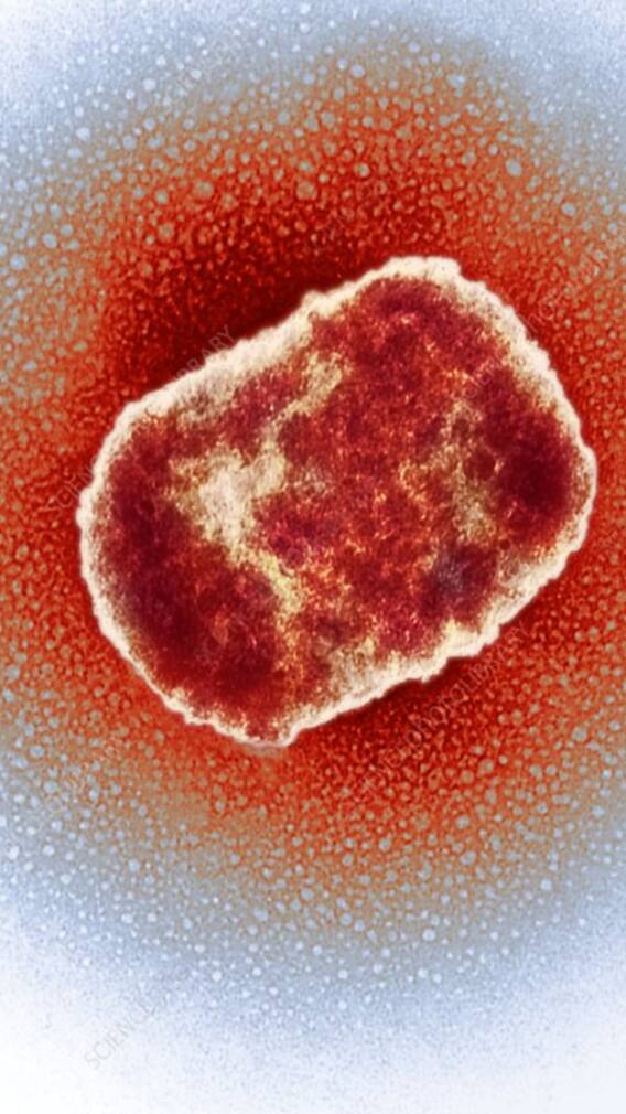 মাঙ্কি পক্স কেন হয়? কাদের হয়?