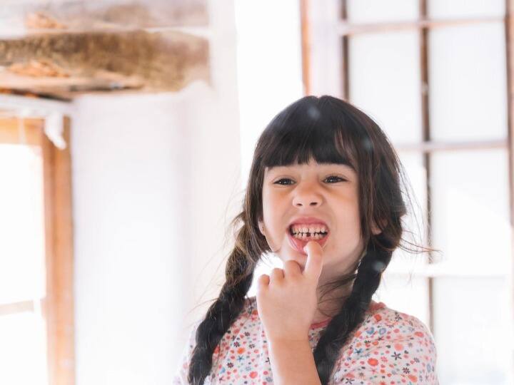 दांतों के बीच गैप होने से आपकी खूबसूरती पर असर पड़ता है. अगर आप दांतों के बीच गैप को ठीक करना चाहते हैं, तो इसके लिए निम्न उपायों का सहारा ले सकते हैं. (Photo - Freepik)