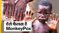 Monkeypox Cases: क्या है इस Monkeypox Virus के लक्षण और कैसे फैलता है ये वायरस?