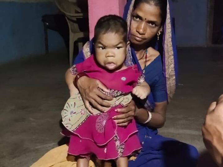 MP world shortest girl with father in Barwani Distric hospital to make Disability Certificate ANN Barwani News: बड़वानी में दुनिया की सबसे छोटी लड़की मिलने का दावा, 17 साल की उम्र में सिर्फ डेढ़ फीट है कद