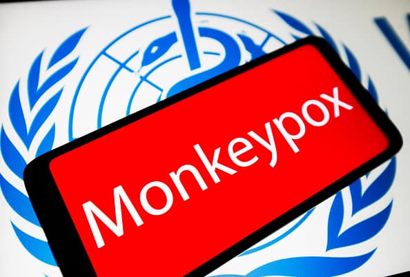 Monkeypox Virus Spreading In Britain Via Community Transmission Monkeypox Virus Spreading In Britain Via Community Transmission, Says Senior Adviser