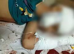 Crime News: ફોઈએ ભત્રીજા પર કર્યો ચપ્પુથી જીવલેણ હુમલો, કારણ જાણીને ચોંકી જશો